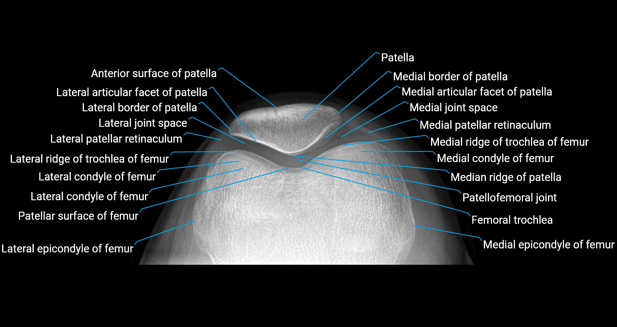 X ray knee skyline view  Anatomy.webp